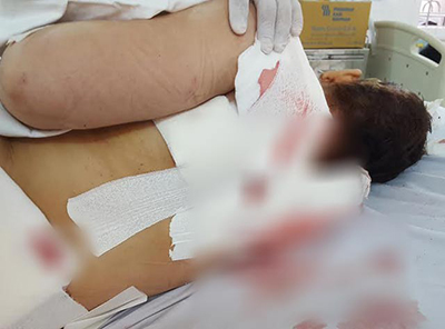 Vợ bị chồng chém dã man vì nghi thuê phòng trọ ngoại tình