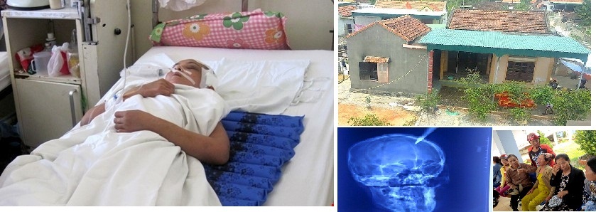 Tin phụ nữ ngày 3/5: Nửa đêm chồng đánh vợ chấn thương sọ não