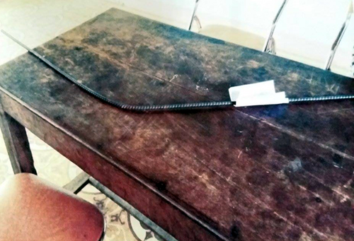 Bé sơ sinh bị hàng xóm đánh chấn thương bằng thanh thép