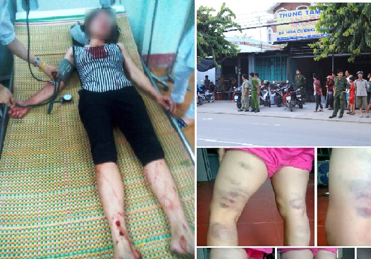 Tin phụ nữ ngày 22/5: Chồng đánh vợ sảy thai vì… không nấu cơm