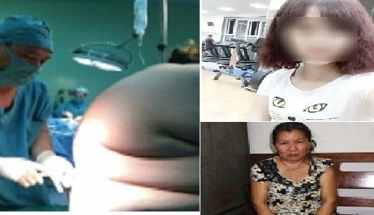 Tin phụ nữ ngày 3/6: Sản phụ nặng 135 kg được mổ thành công