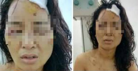 Nguyên nhân khiến cô giáo bị chồng đánh đập dã man ở Phú Thọ