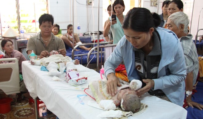 2 cháu bé trong vụ đổ xăng đốt cả nhà mẹ vợ đang nguy kịch
