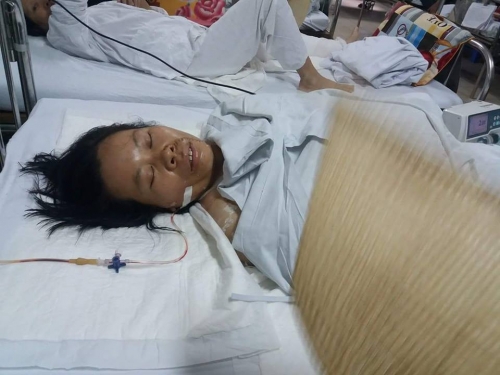 Vụ chồng chém vợ gần đứt bàn tay: