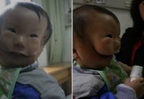 Đau buồn đứa bé có khuôn mặt