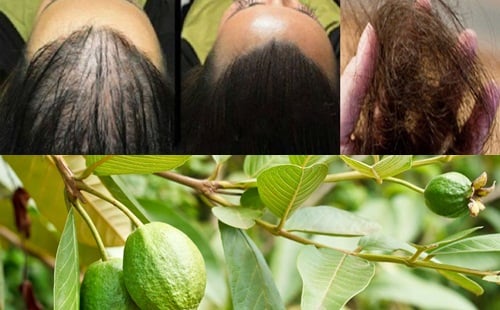 Tóc tôi hết khô xơ, gãy rụng mềm mượt như nhung chỉ nhờ lá ổi