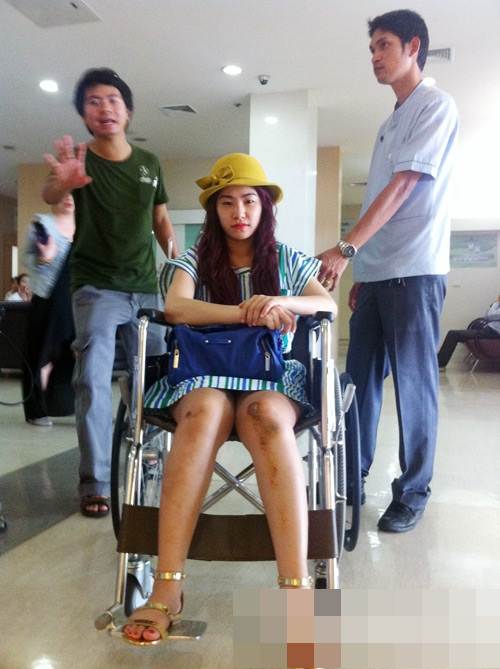 Ca sĩ Lương Bích Hữu bị bỏng nặng