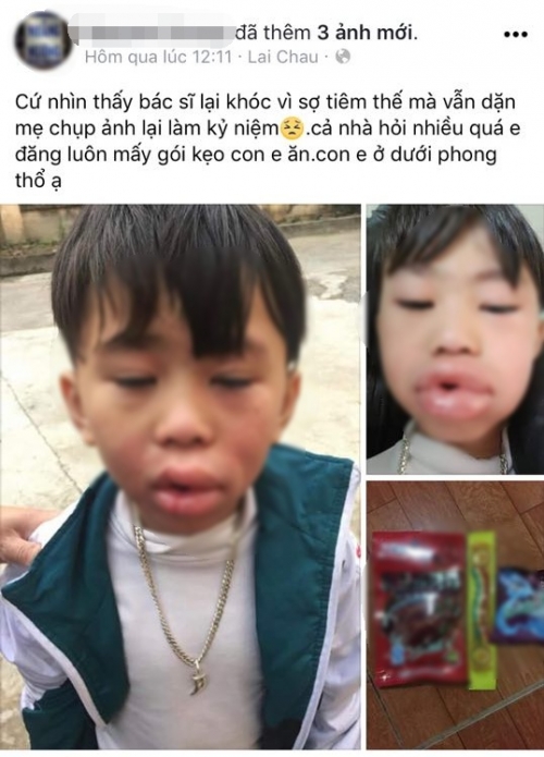 anh1
