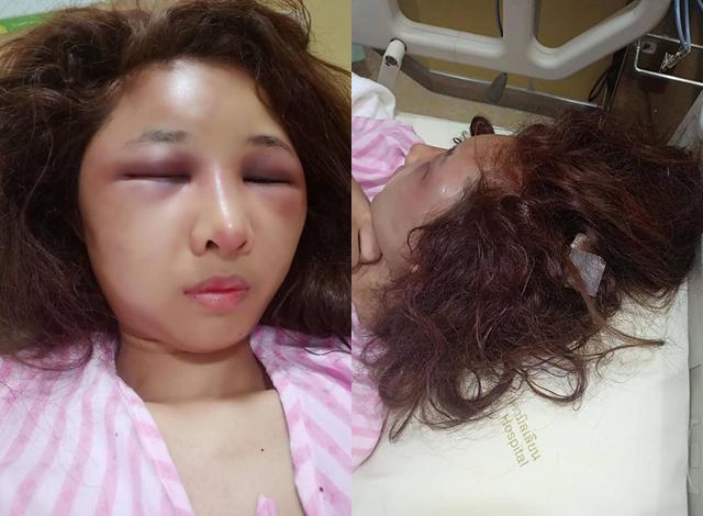 Người vợ bị đánh rất dã man