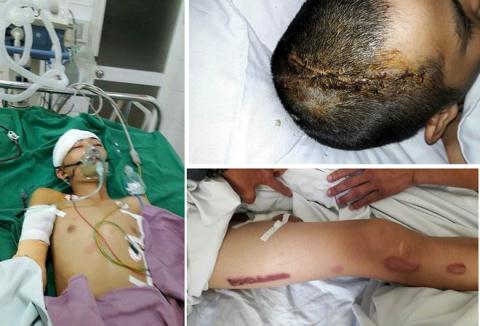 T. bị tổn hại 92% sức khỏe