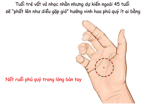 not-ruoi-nam-trong-long-ban-tay