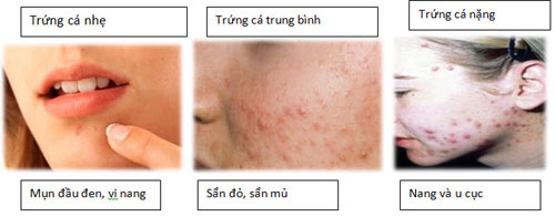 bat-mi-cach-tri-mun-trung-ca-bang-toi-4