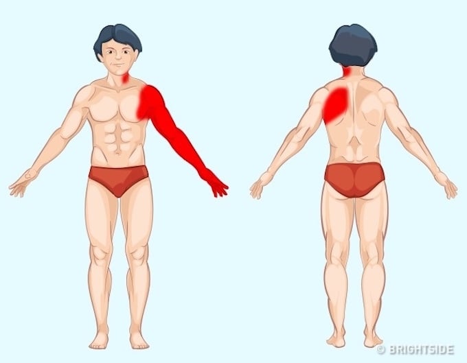 Tim: Nếu đang mắc các bệnh về tim mạch, bạn sẽ thấy đau ngực và cơn đau có thể lan tới cánh tay trái, phần lưng gần bả vai và cả phần cổ. Không giống như các bộ phận khác, đau tim thường không ảnh hưởng đến vận động hoặc hô hấp của bạn.