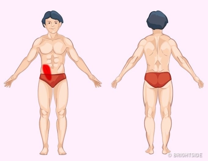Ruột già: Khác với đau ruột non, dù cùng xuất hiện ở vùng ổ bụng, hiện tượng bất thường ở ruột già sẽ bắt đầu bằng cơn đau ở vùng mạn sườn bên phải. Thông thường, người bệnh sẽ đồng thời cảm thấy đau quặn bụng như ruột bị cuốn lại, bụng bị đầy hơi, chướng to.