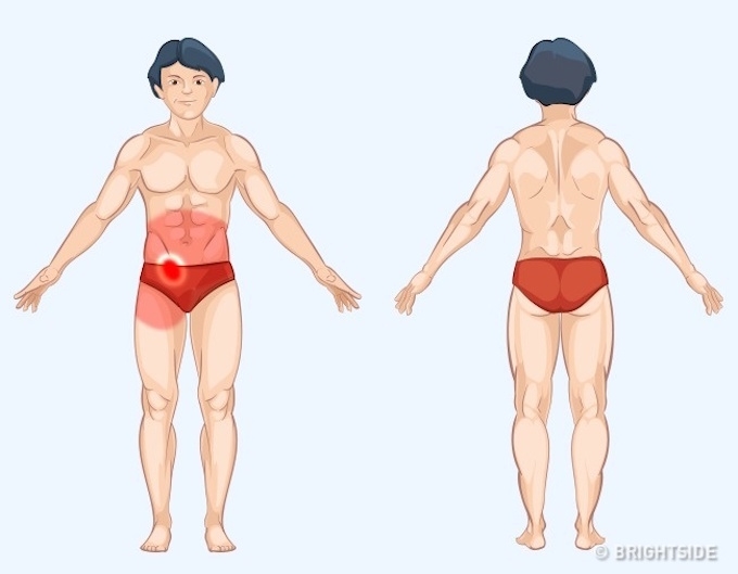 Ruột thừa: Cơn đau ruột thừa thường xuất hiện tập trung quanh vùng rốn và vùng bụng dưới (hạ vị) bên phải, đây cũng chính là vị trí của ruột thừa trong Sh88bet đăng ký miễn phí. Đau ruột thừa nếu không được chữa trị kịp thời có thể sẽ gây nguy hiểm đến tính mạng.