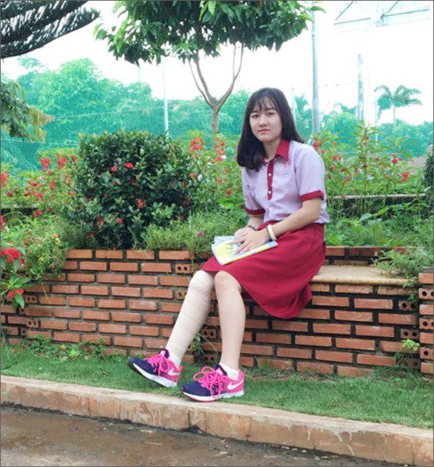 nu-sinh-bi-cua-chan-2