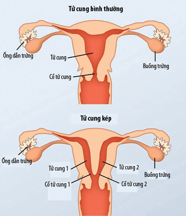 phu-nu-co-2-tu-cung-2