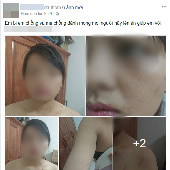 con-dau-bi-danh-1