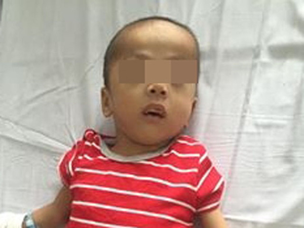 cho-can-dut-bo-phan-sinh-
