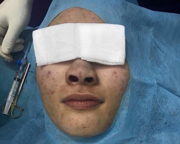 nang-mui-1