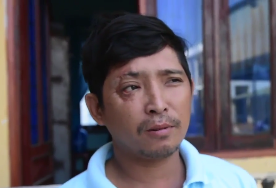 Tài xế Ngô Anh Khôi, chủ chiếc xe tải bị thiêu rụi (ảnh từ video)