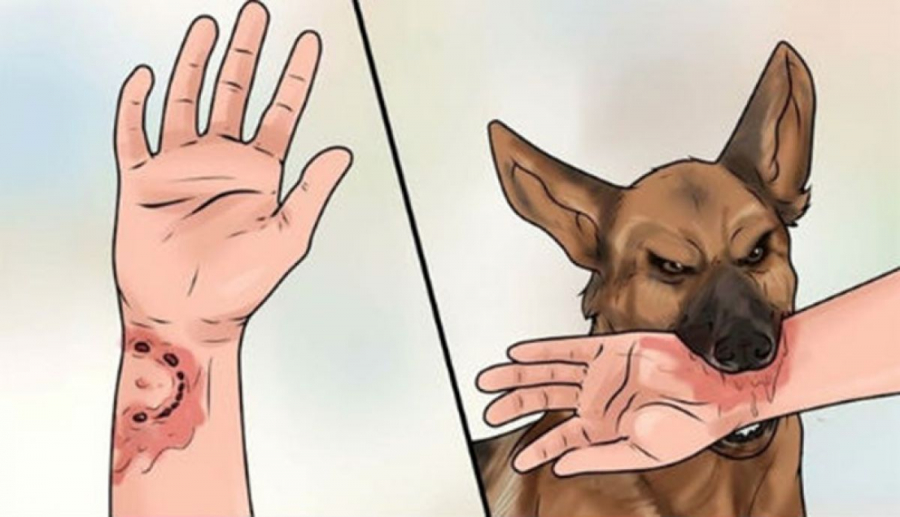 Nếu xử lý kịp thời và đi tiêm phòng dại, mọi người sẽ tránh khỏi cái chết sau khi bị chó cắn