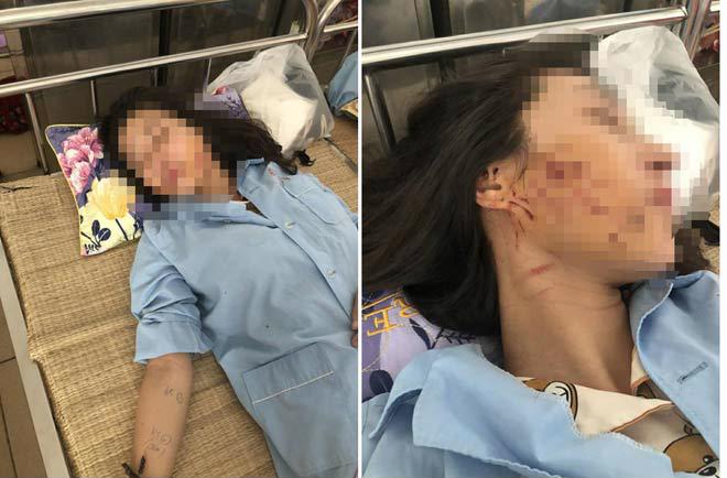 Nạn nhân G. vẫn đang phải điều trị trong bệnh viện