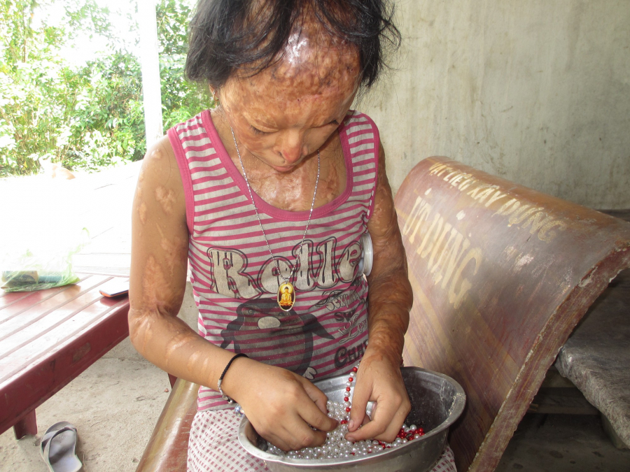 Nguyện vọng của bà nội giờ chỉ mong tìm kiếm lại được ánh sáng cho đôi mắt của đứa cháu tội nghiệp