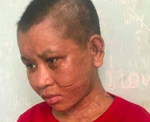 Y Nhiêu - cô gái bị chủ hành hạ đến sảy thai, biến dạng mặt đến mức mẹ đẻ không nhận ra