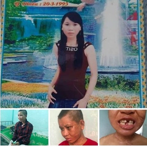 Nhan sắc của Y Nhiêu trước và sau khi bị hành hạ