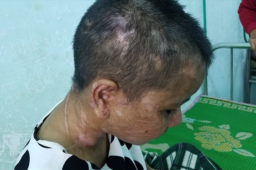 Y Nhiêu bị tra tấn dã man