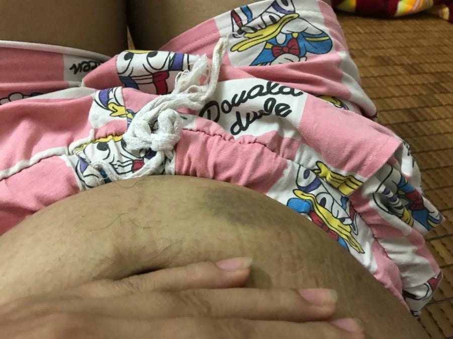 Bụng bầu của cô gái lỡ có thai với 