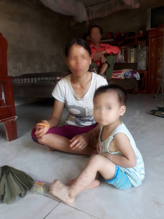 Nguyên nhân dẫn đến việc bé 18 tháng tuổi nhiễm HIV do thói quen sinh hoạt hàng ngày