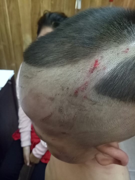 Đối tượng khai nhận khi đánh con riêng của vợ, hắn có sử dụng ma túy đá