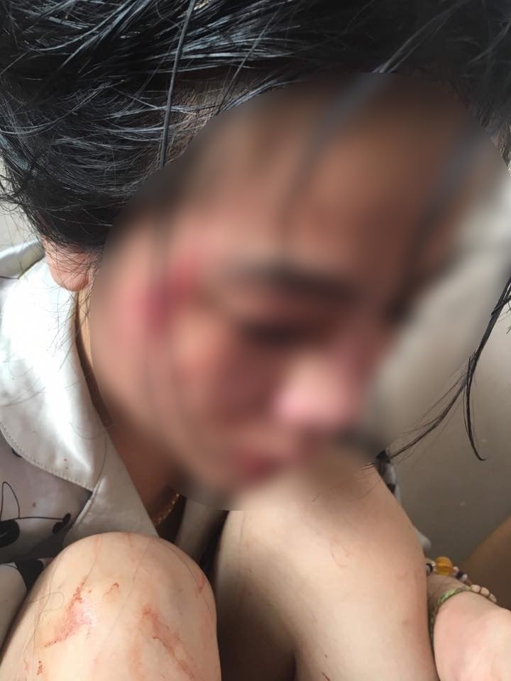 Cô gái tên P. nhận mình là người bị đánh đã gửi đơn lên CA để xử lý