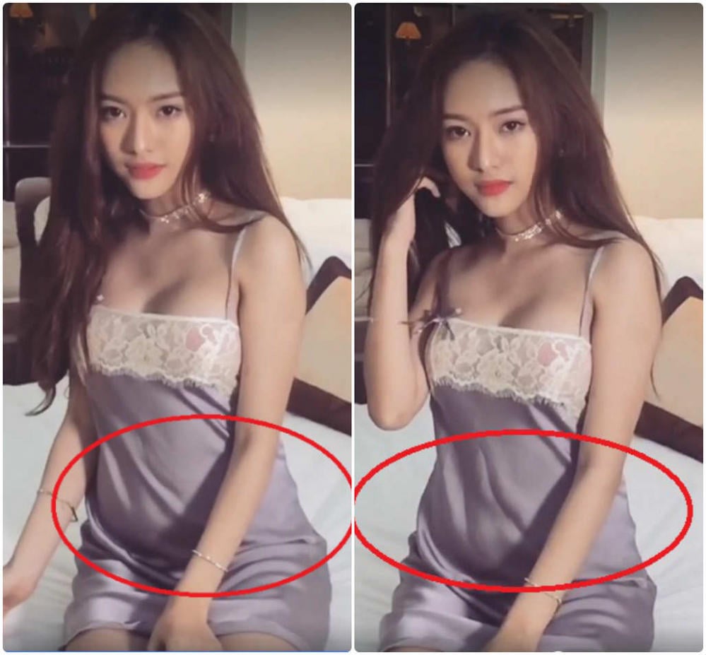 thuy vi lo diem bat thuong tren co the (2)