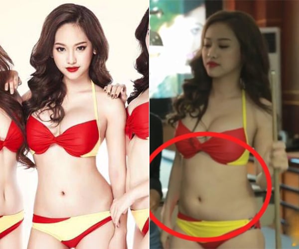thuy vi lo diem bat thuong tren co the (6)