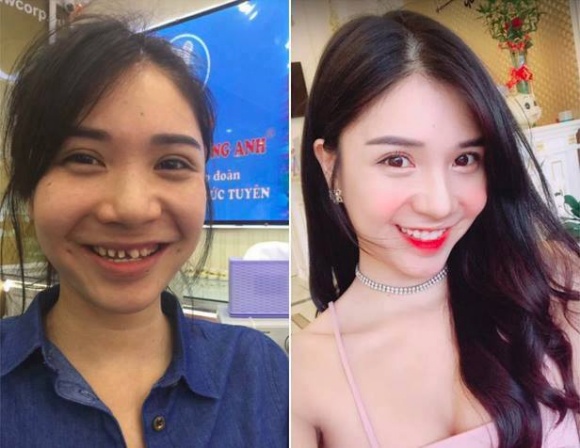 thanh bi (1)