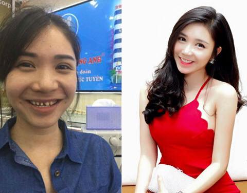 quang le thanh bi (3)