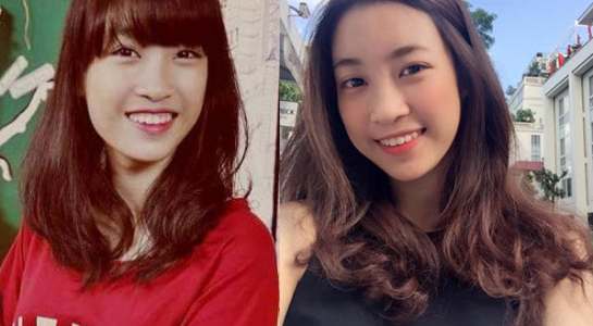 do my linh bi to chinh su