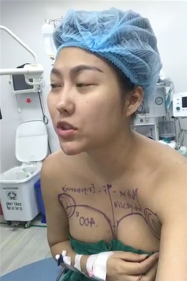phi thanh van khoe mat mo