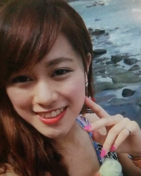 phau thuat tham my 30 lan
