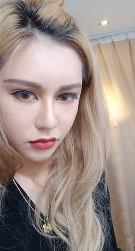 phau thuat tham my 30 lan