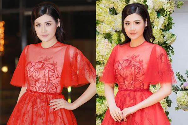 a hau tu anh phau thuat tham my (7)