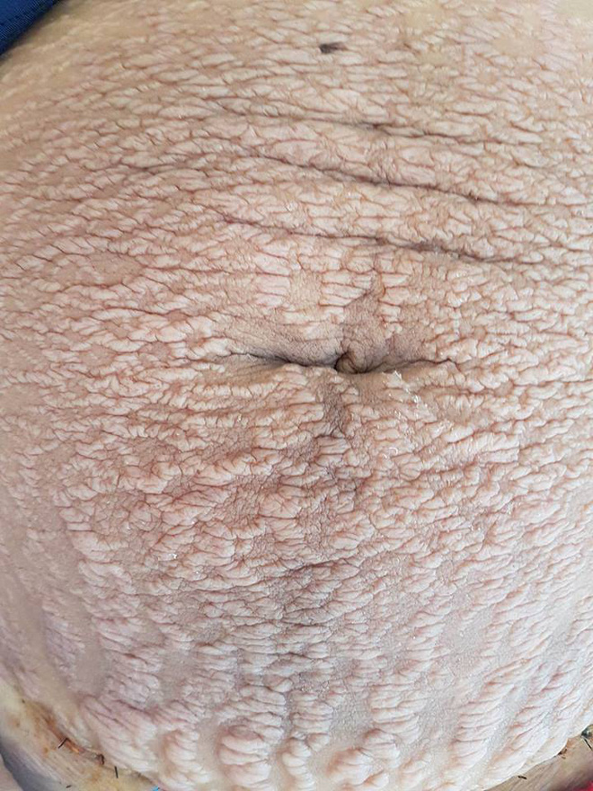 img20170715231527312