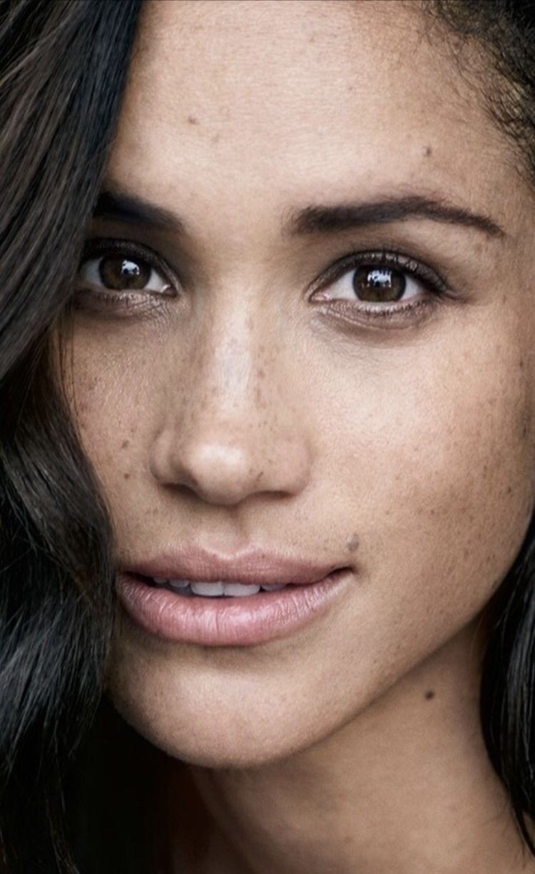 Công nương Meghan Markle đã khiến tàn nhang trở thành 