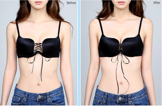 So với khi mặc áo lót bình thường (ảnh trái) và áo lót dây rút (ảnh phải), có thể thấy rõ kích cỡ vòng 1 thay đổi rõ rệt.    