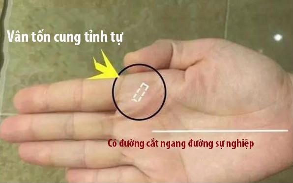 1 anh bia
