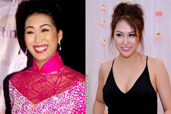Phi Thanh Vân trước đây có hàm răng khấp khểnh, nụ cười hở lợi kém duyên. Cô đã nhiều lần chỉnh sửa để có hàm răng thẳng tắp như hiện tại.    