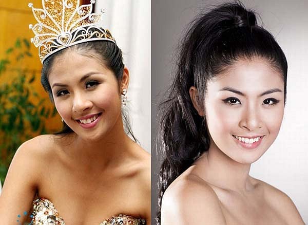Hàm răng khấp khểnh từng gây “mất điểm” một thời của Ngọc Hân giờ đã được thay thế bằng nụ cười tỏa sáng. Gương mặt cô trở nên rạng rỡ hơn sau khi chỉnh răng.    